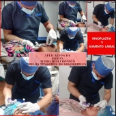 Rinoplastia y aumento labial - Clínica dental CIEE