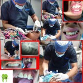 Dentistas en Puebla - Clínica dental CIEE