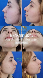 Cirugía estética y Bariatría en Puebla - Dr. Mario Salazar Olivares - Puebla