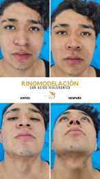 Cirugía estética y Bariatría en Puebla - Dr. Mario Salazar Olivares - Puebla